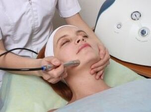 Rejuvenescimento a laser do rosto
