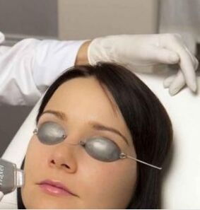 Rejuvenescimento do laser de campo