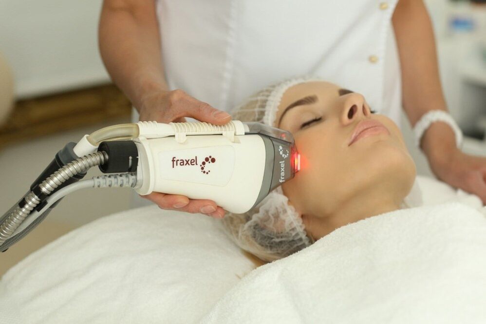 Rejuvenescimento a laser