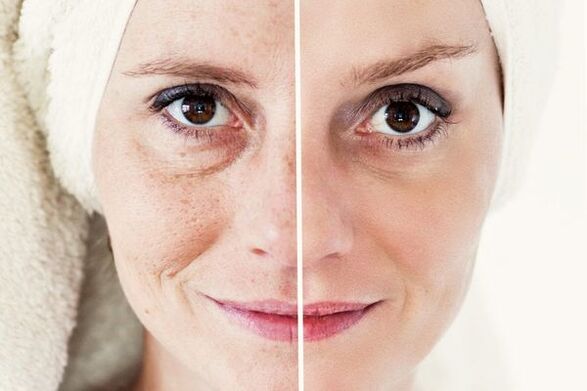 antes e depois