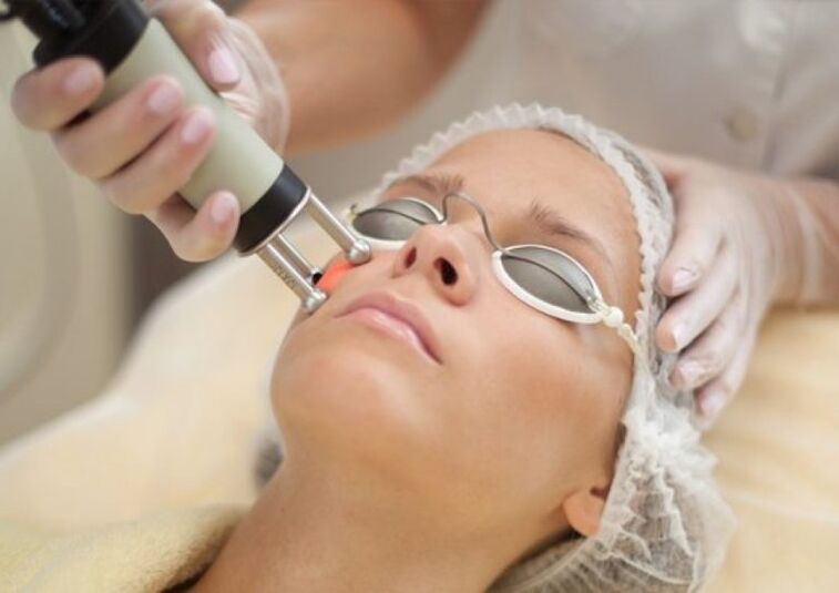 Procedimento de rejuvenescimento a laser de campo