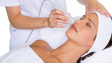 Como se preparar para o procedimento de rejuvenescimento facial fracionado