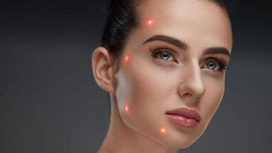 O que é rejuvenescimento fracionado da pele