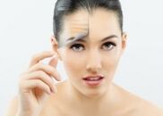 Menina após rejuvenescimento facial a laser fracionado