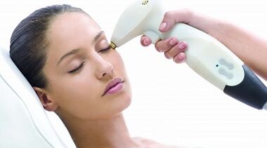 Como é realizado o rejuvenescimento fracionado da pele