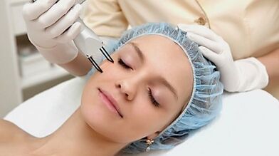 procedimento fracionado de rejuvenescimento da pele facial