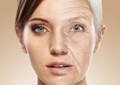 antes e depois do rejuvenescimento da pele facial a laser