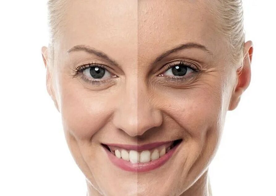 melhores tratamentos cosméticos faciais