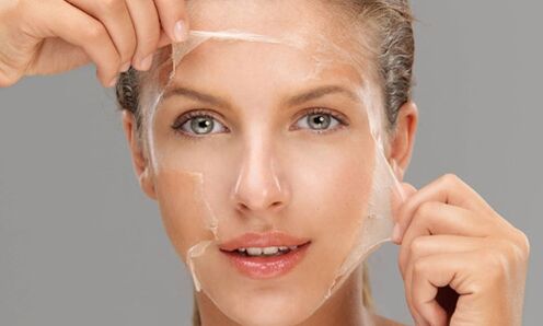 O peeling profundo potencializa os processos de regeneração da pele, rejuvenescendo-a